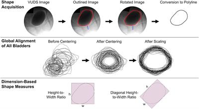 Use of statistical shape modeling to enhance the fluoroscopic evaluation of the bladder